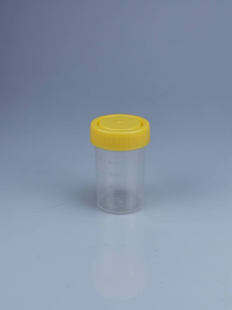 Urine Sample Bottle 50ml